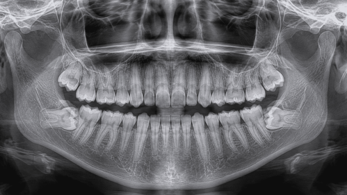 Oral Surgery in Miami Pediatric Dental Centers