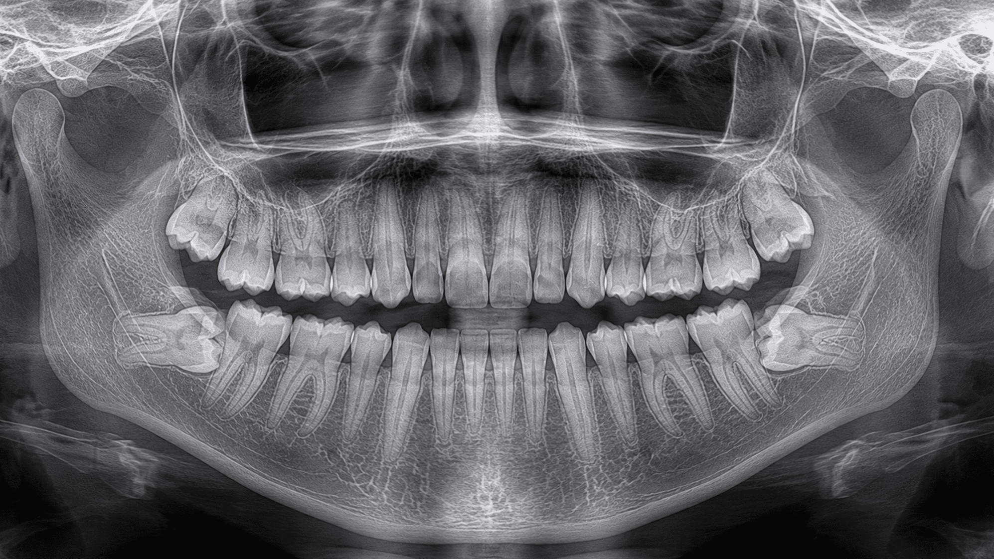 Oral surgery for kids in Miami